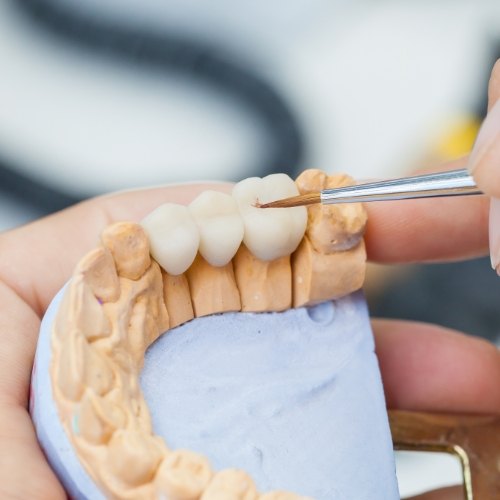 Dentist designing a lifelike dental crown