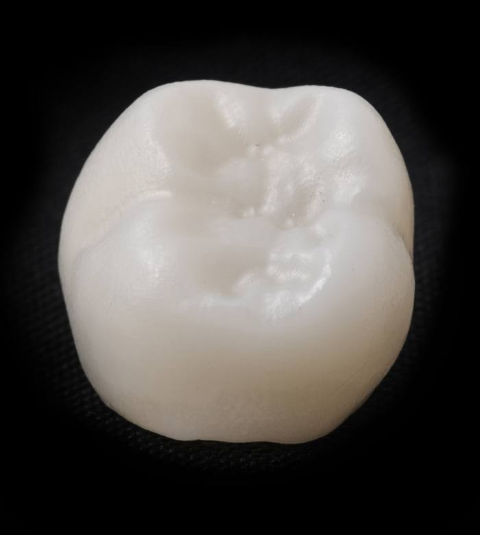 Close up of CEREC one visit dental crown in Norman against black background