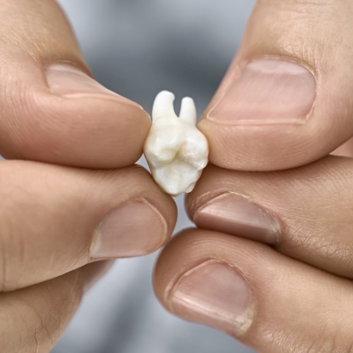 Person holding an extracted tooth in their hand