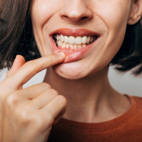 Woman pulling down her lower lip to show her gums