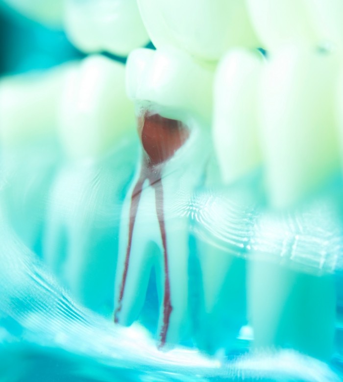 Close up model of a tooth showing the root canals inside of it