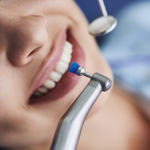 Close up of a dental cleaning instrument near a patient's mouth