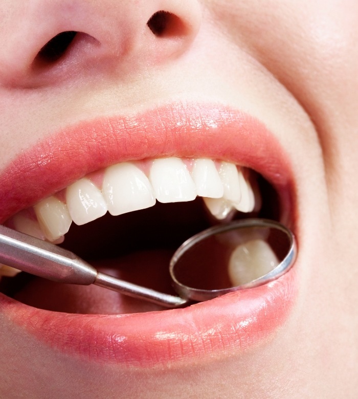 Close up of a mouth with a dental mirror inside of it