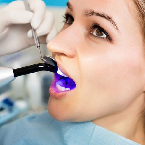 Dentist whitening a patient’s teeth