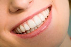 porcelain veneers