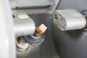 CEREC milling machine at dentist's office